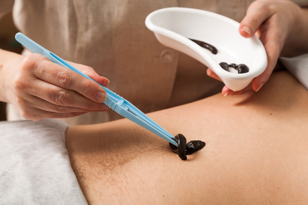 زالودرمانی